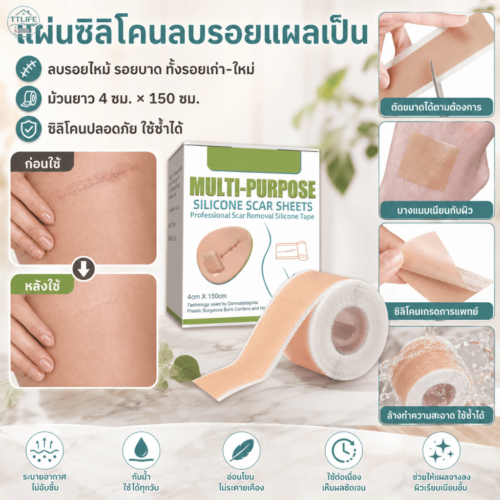 【คลังในประเทศ+COD】แผ่นลดรอยแผลเป็นซิลิโคน ยาวม้วน 4x150ซม. ใช้ซ้ำได้ บำบัดรอยแผลผ่าตัดและแผลไหม้ ฟื้นฟูผิวหนัง