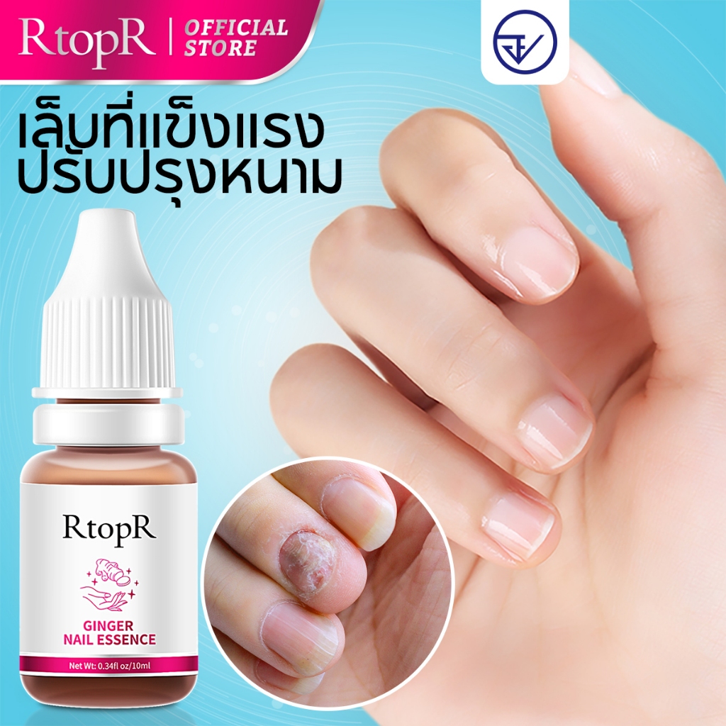 RtopR【FDA】 น้ำมันบำรุงเล็บสารสกัดขิง - เซรั่มบำรุงเล็บที่มีวิตามิน C และกรดไฮยาลูโรนิก ช่วยบำรุงเล็บให้เงางาม ดูแลขอบเล็บ ป้องกันการเกิดหนังหนาและซ่อมแซมเล็บที่แตกหักและเสียหาย ขนาด
