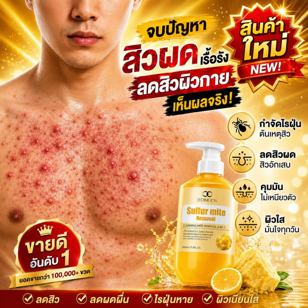 ครีมอาบน้ำซัลเฟอร์ทำความสะอาดล้ำลึก กำจัดไรฝุ่นและแก้คัน ช่วยลดสิวหลังและรูขุมขนอักเสบอย่างเห็นผลจริง สูตรอ่อนโยนเหมาะกับผิวบอบบางแพ้ง่าย ขนาดสุดคุ้ม 500 มล