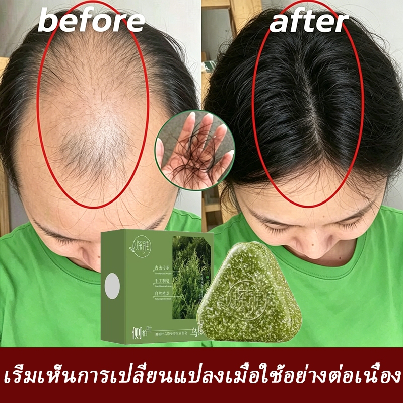 ⚡สินค้าแท้⚡ TANYA Herbal สบู่ปลูกผม120g ลดผมร่วง บำรุงรากผม ผมหนาขึ้น แชมพูสมุนไพร หนังศีรษะแข็งแรง