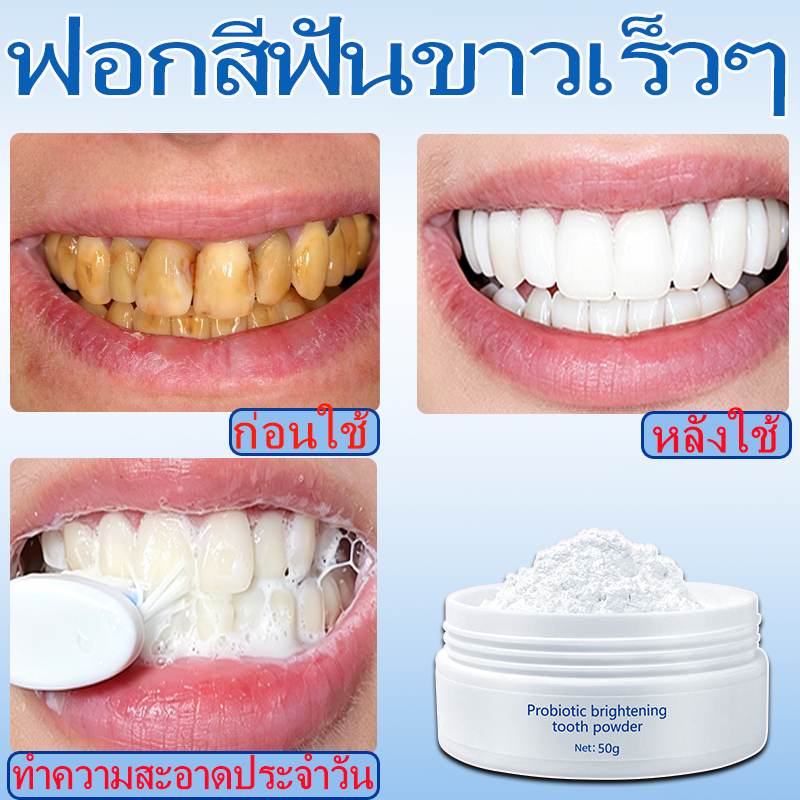LYDIMOONผงขัดฟันขาว ยาสีฟันฟันขาว ผงฟอกสีฟัน50g สูตรไข่มุก ลดหินปูน ลดคราบฟันเหลือง ลดกลิ่นปาก   ลมหายใจสดชื่นl 50g