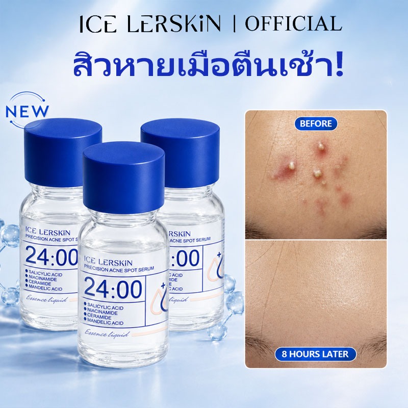 【ซื้อ 1 แถม 1】ICELERSKIN acne Serum Anti acne Lotion 10ml (ลดรอยแดง ลดการอักเสบ ช่วยลดรูขุมขนและสิว) รักษาสิว salicylic acid acne crea