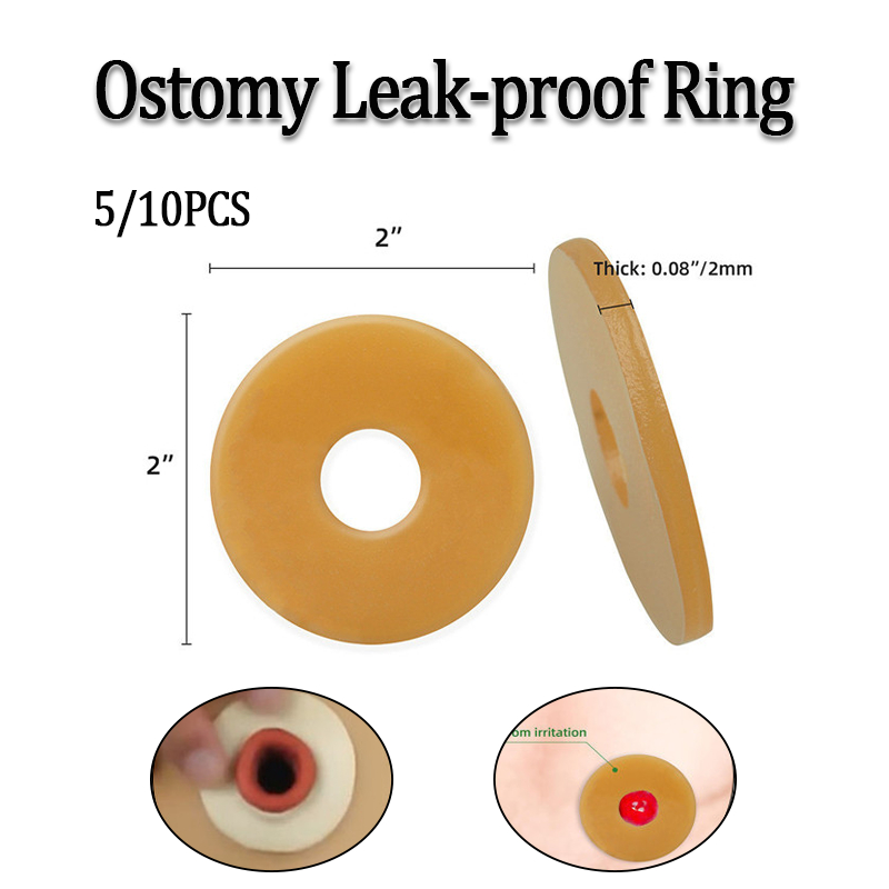 Ostomy Barrier Ring Anti-Leak Mouldable Stoma Seal แหวนป้องกันผิวป้องกัน Peristomal Irration