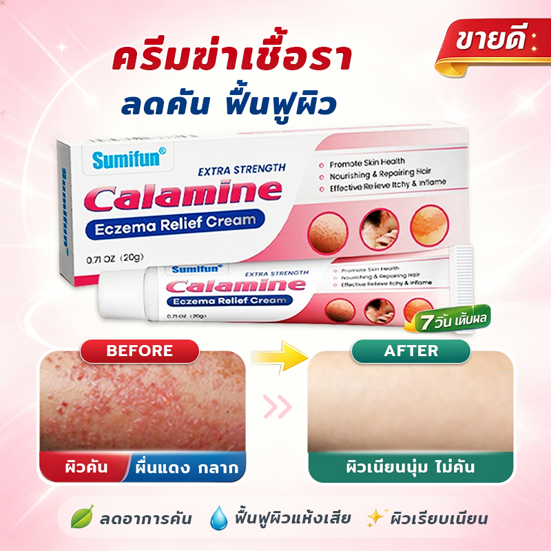 MEDVA ครีมแก้คัน ครีมคาลาไมน์ ลดผื่นแดง ผิวลอก กลาก เกลื้อน เชื้อราผิวหนัง น้ำกัดเท้า สูตรเข้มข้น ส่งจากไทย