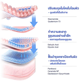 ICE LERSKIN Acne Clear Body Acne Spray สเปรย์ลดสิวผิวกาย สเปรย์ฉีดสิว ฆ่าเชื้อสิว และลดการเกิด ใช้ได้ทั้งหน้า และลำตัว