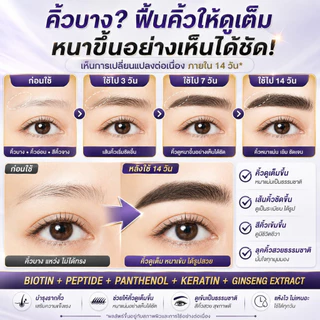 เซรั่มคิ้ว เซรั่มขนตา เซรั่มขนตาหนายาว คิ้วดก ขนตาแข็งแรง ลดขนตาร่วง แก้คิ้วบาง ปลูกง่าย ซึมไว ไม่ระคายเคือง ผิวบอบบาง ใช้ง่าย ทุกเพศ 30g
