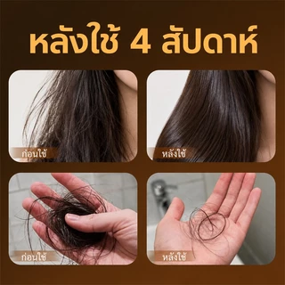 SEVICH สบู่แชมพูดํา 120ก Natural Hair Wash Bar สบู่สมุนไพรธรรมชาติป้องกันผมร่วงและสบู่ตัวแทนเสริมสร้างเส้นผม