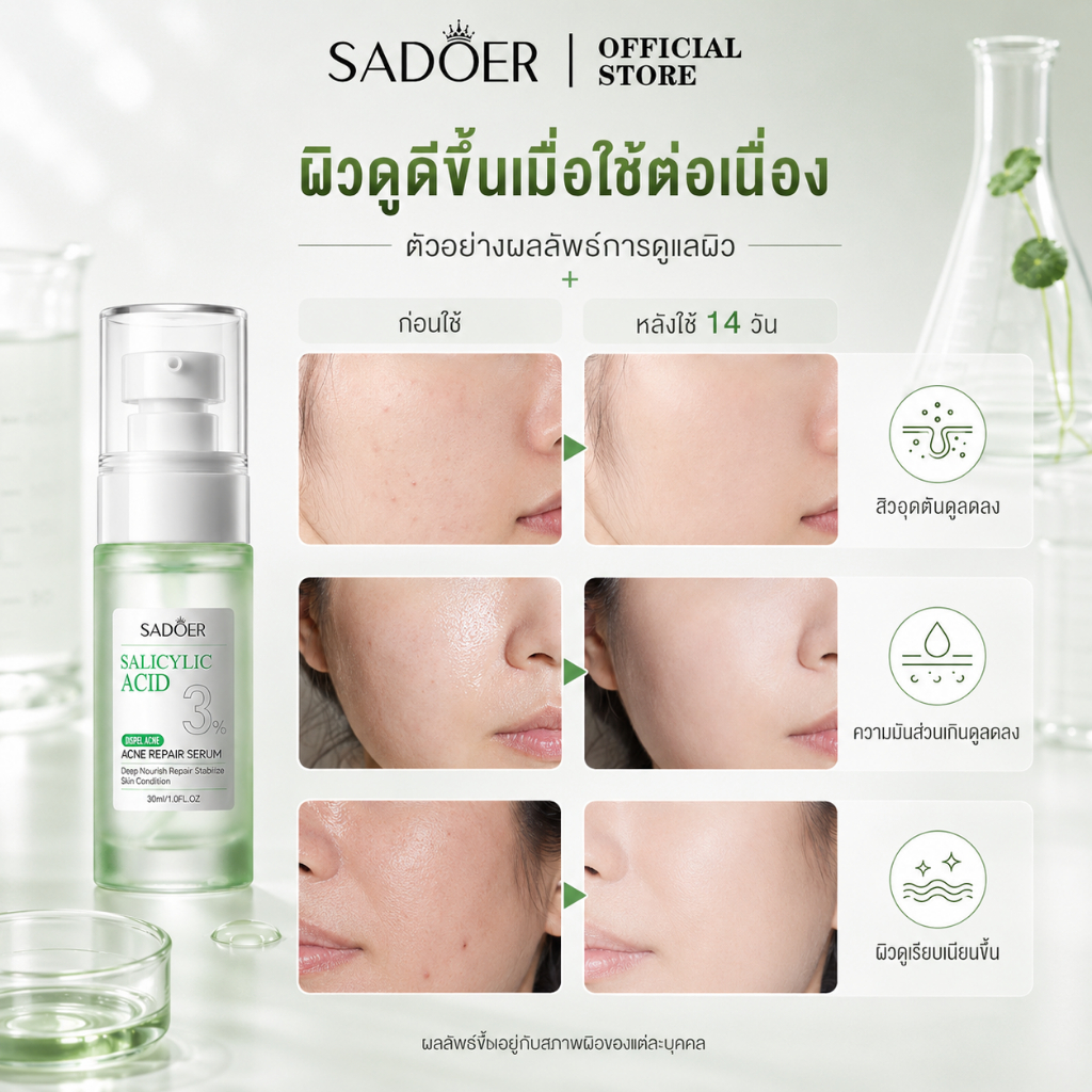 SADOER3% ซาลิไซลิก แอซิด แอคเน่ เซรั่ม ช่วยลดขนาดรูขุมขนและปรับสภาพผิวที่เป็นสิวง่ายและรอยแผลเป็นจากสิว — صورة 4