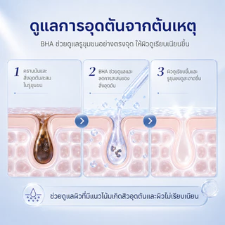 ICELERSKIN Acne reducing gel เจลลดสิว ลดรอยแดง-อักเสบ-รูขุมขน แต้มสิวเห็นผลไว ด้วยกรดซาลิไซลิก