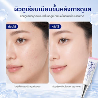 ICELERSKIN Acne reducing gel เจลลดสิว ลดรอยแดง-อักเสบ-รูขุมขน แต้มสิวเห็นผลไว ด้วยกรดซาลิไซลิก