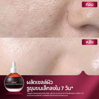 PAPA FEEL 8% AHA 1% BHA 0.5% PHA RADIANT Peeling Solution 30ml
