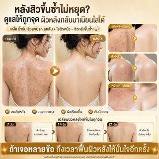 ครีมอาบน้ำซัลเฟอร์ทำความสะอาดล้ำลึก กำจัดไรฝุ่นและแก้คัน ช่วยลดสิวหลังและรูขุมขนอักเสบอย่างเห็นผลจริง สูตรอ่อนโยนเหมาะกับผิวบอบบางแพ้ง่าย ขนาดสุดคุ้ม 500 มล