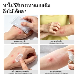 GOKOCO Bug Bite Itch Reliever บรรเทากัดเทคโนโลยีความร้อนอัจฉริยะตามธรรมชาติเหมาะสําหรับการชาร์จแบบพกพาของทารก