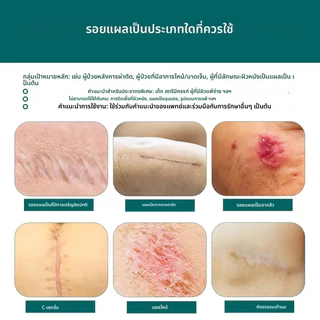 【ของแท้ 100%🔥】Dr.Jungle แผ่นแปะลบแผลเป็น 4*150cmรักษาแผลเป็น ใช้สำหรับลบด่างดำ scar silicone แผ่นแปะลบรอยด่างดำ ออกฤทธิ์เร็วและมีประสิทธิภาพในการกำจัดรอยด่างดำและรอยแผลเป็น