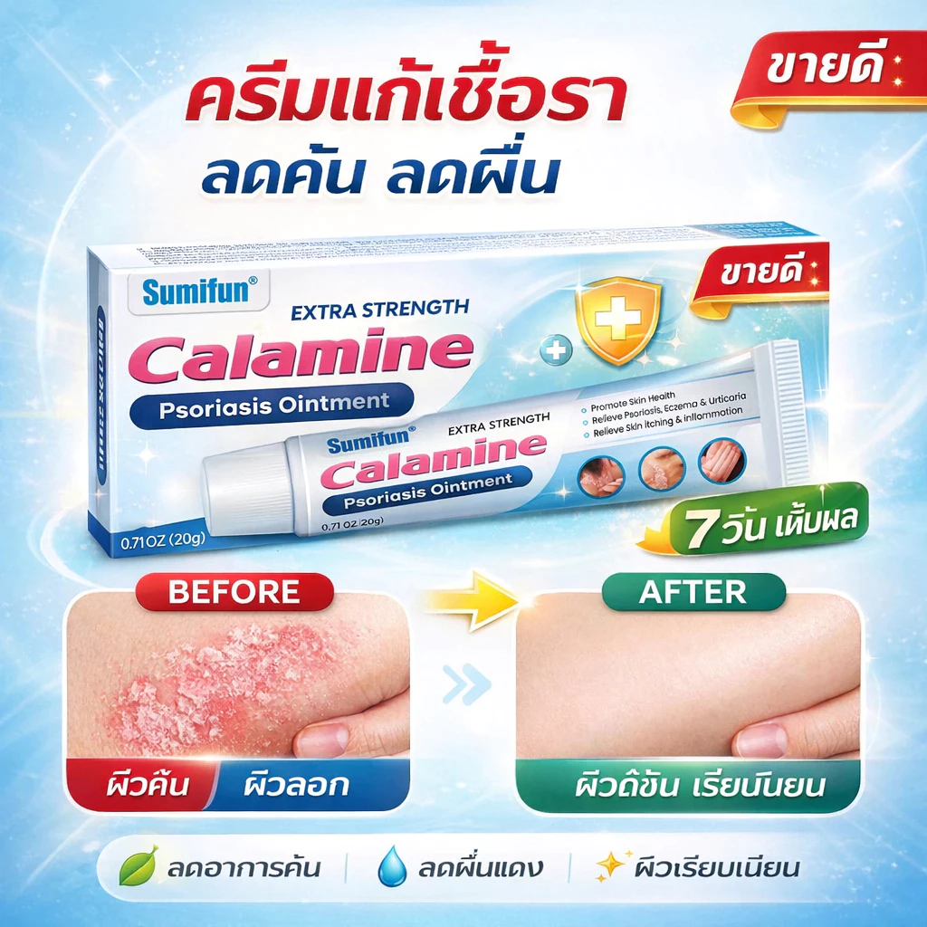 ⚡ หยุดคันเร็ว ⚡ครีมแก้เชื้อรา ช่วยยับยั้งเชื้อรา บรรเทาอาการคันและผิวลอก เนื้อครีมบางเบา