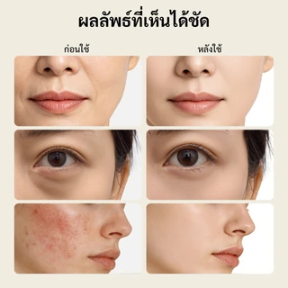 GOKOCO 4 in 1 EMS เครื่องนวดหน้าประคบร้อนการสั่นสะเทือนสีแดง Blue Light Therapy Lift & Firm
