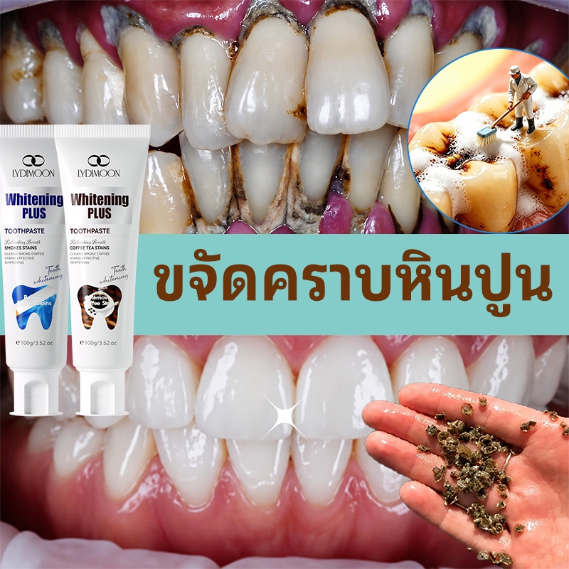 LYDIMOON ยาสีฟันฟันขาว ยาสีฟันสมุนไพร ยาสีฟันฟอกฟันขาว 100g ฟอกสีฟัน ลดคราบฟันเหลือง ลดฟันเหลือง ลดห
