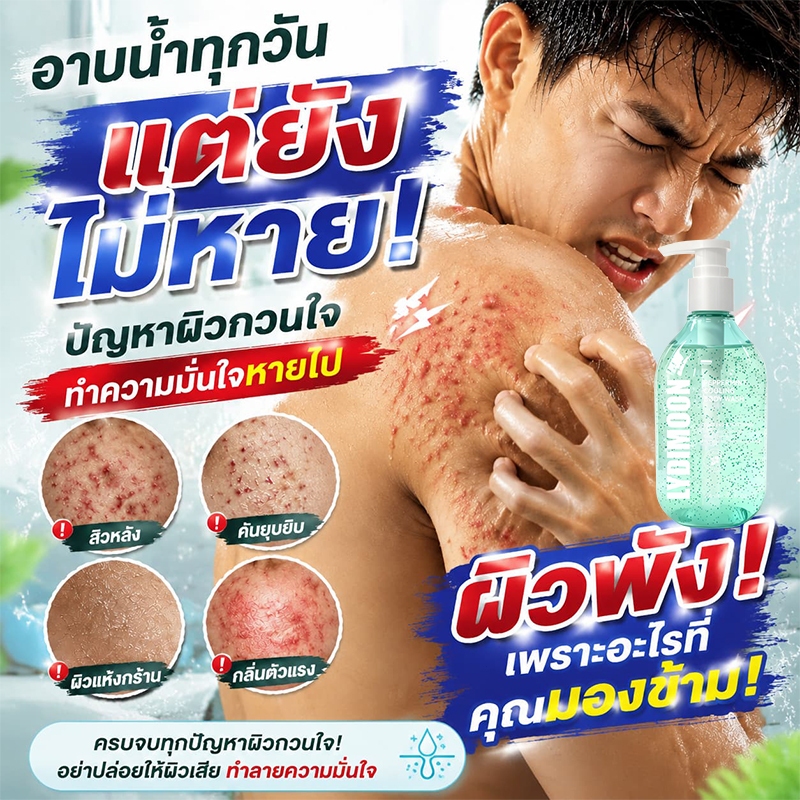 ครีมอาบน้ำลดสิว แก้คัน ครีมอาบน้ำกำจัดไรขนุด ควบคุมความมัน ลดสิว ต่อต้านเชื้อรา แก้คัน ให้ความชุ่มชื้นอ่อนโยน กลิ่นหอมติดทน ผ่อนคลาย สดชื่น 300 มล