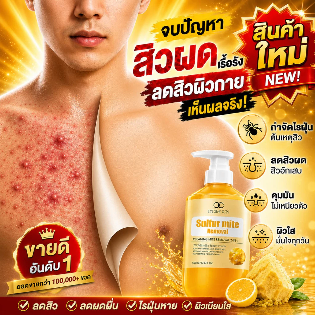 ครีมอาบน้ำซัลเฟอร์ทำความสะอาดล้ำลึก กำจัดไรฝุ่นและแก้คัน ช่วยลดสิวหลังและรูขุมขนอักเสบอย่างเห็นผลจริง สูตรอ่อนโยนเหมาะกับผิวบอบบางแพ้ง่าย ขนาดสุดคุ้ม 500 มล
