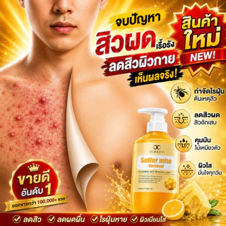 ครีมอาบน้ำซัลเฟอร์ทำความสะอาดล้ำลึก กำจัดไรฝุ่นและแก้คัน ช่วยลดสิวหลังและรูขุมขนอักเสบอย่างเห็นผลจริง สูตรอ่อนโยนเหมาะกับผิวบอบบางแพ้ง่าย ขนาดสุดคุ้ม 500 มล