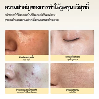 GOKOCO เครื่องดูดสิวเสี้ยนสำหรับมือใหม่ ระบบน้ำและออกซิเจน 4 ระดับแรงดูด 6 หัวดูด กำจัดสิวหัวดำ ทำความสะอาดรูขุมขน ทำความสะอาดผิวหน้า