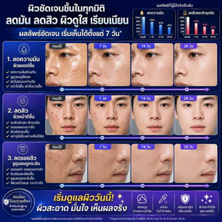 LYDIMOON โฟมล้างหน้าผู้ชายสูตรอะมิโน 100g ✨ กดใช้เลย! ฟองนุ่มละเอียด คุมมันอ่อนโยน ล้างล้ำลึกลดสิว ผิวสดชื่นไม่ตึง ✨