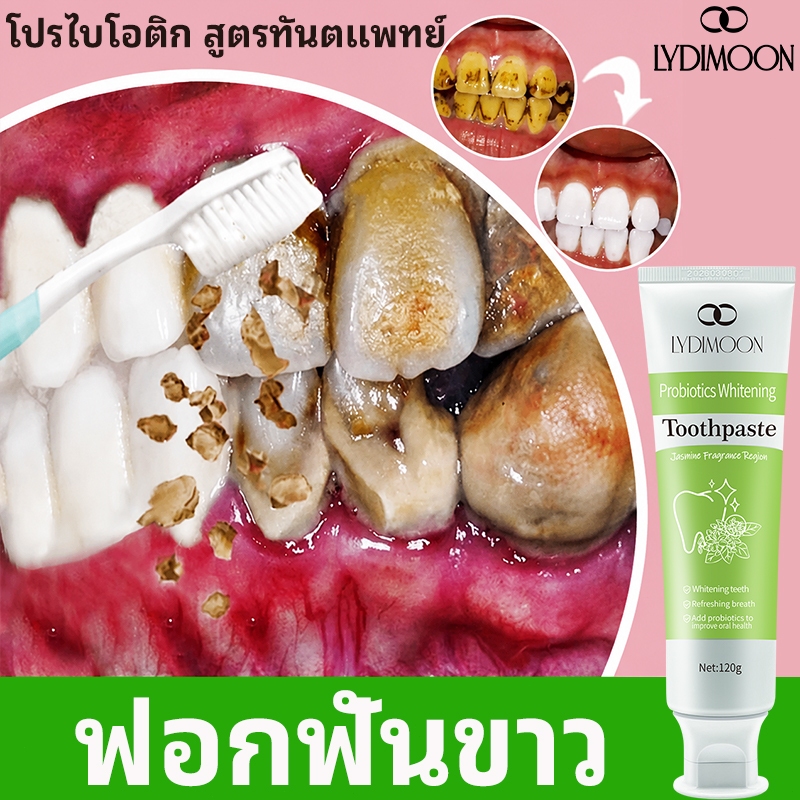 LYDIMOON ยาสีฟันไวท์เทนนิ่ง ยาสีฟันโปรไบโอติก 120g ฟอกฟันขาว ลมหายใจสดชื่น กลิ่นปากคราบพลัค สูตรทันต