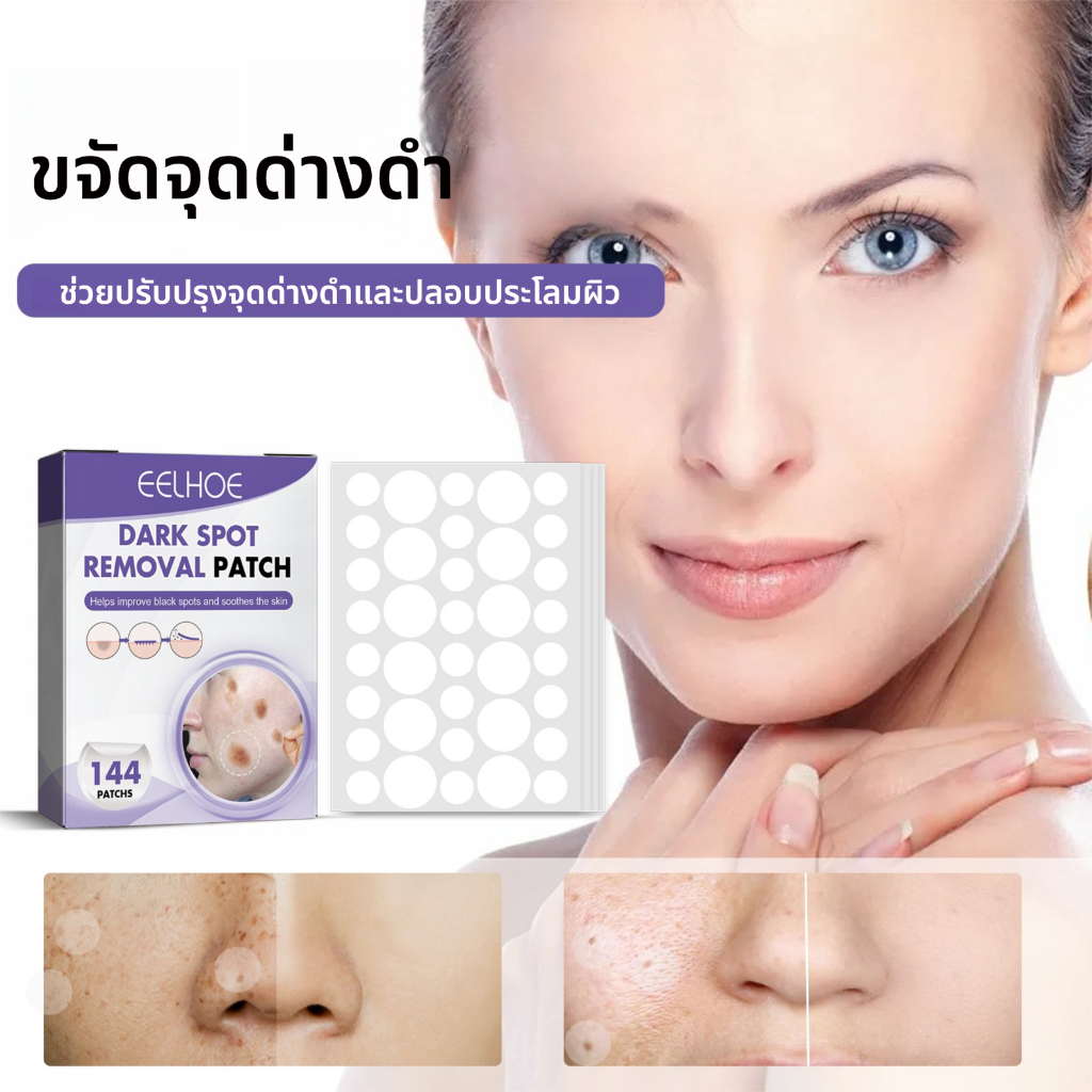 EELHOE  แพทช์แก้ไขจุดด่างดำใบหน้า, กำจัดสิว, คอนซีลเลอร์, เพิ่มความสว่าง เจือจาง, ฝ้า, จุดที่มองไม่เห็น