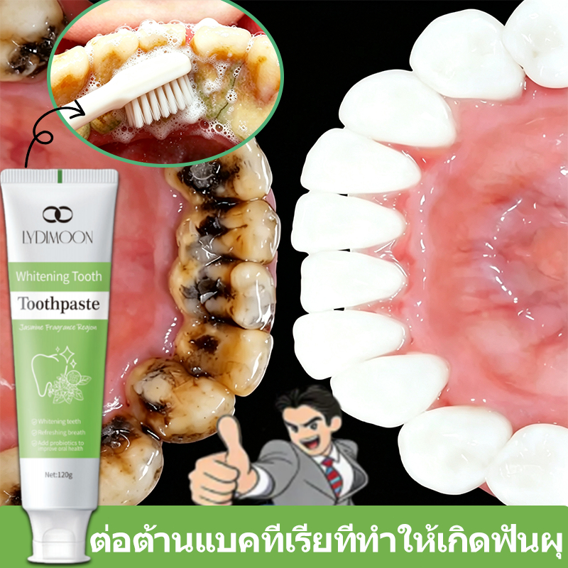 ยาสีฟันโปรไบโอติกไวท์เทนนิ่ง 120ก ขจัดคราบจุลินทรีย์แบคทีเรียซ่อมแซมฟันผุทันตแพทย์สูตรลดคราบเหลือง