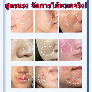 LYDIMOON โฟมล้างหน้าผู้ชายสูตรอะมิโน 100g ✨ กดใช้เลย! ฟองนุ่มละเอียด คุมมันอ่อนโยน ล้างล้ำลึกลดสิว ผิวสดชื่นไม่ตึง ✨