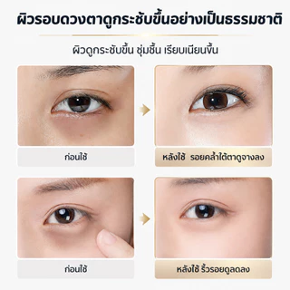 【PORCOPE】ลดขอบตาดำ Eye Cream อายครีม ลดริ้วรอย แก้ขอบตาคล้ำ ฟื้นฟูใต้ตา กระชับใต้ตา 20g