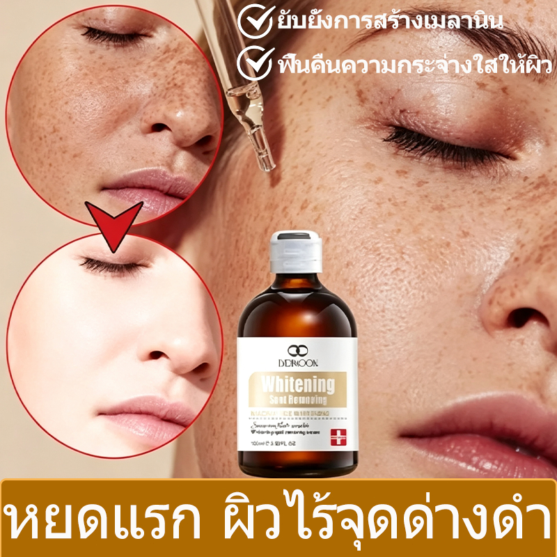 LYDIMOON เซรั่มลดฝ้า เซรั่มลดฝ้า ไวท์เทนนิ่งผิวหน้  ลดเลือนฝ้า กระ สีผิวสม่ําเสมอ  ลบเมลานิน ขจัดผิวหมองคล้ำหน้าใส 100ml