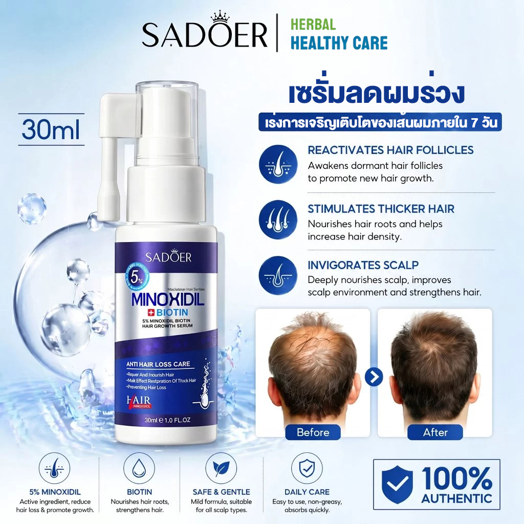 เซรั่มบำรุงผม SADOER ลดผมร่วง ผมบาง ฟื้นฟูผมเสีย Hair Growth Serum 30ml