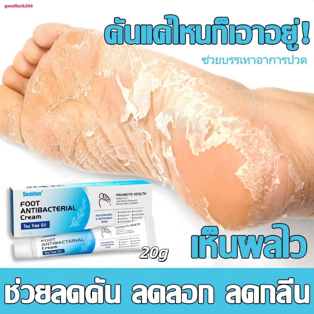 ครีมทาเท้าต้านอาการคันและเชื้อรา ควบคุมกลิ่นเท้าได้อย่างมีประสิทธิภาพ บรรเทาอาการคัน ป้องกันกลิ่น และเหมาะสำหรับเท้าเหม็