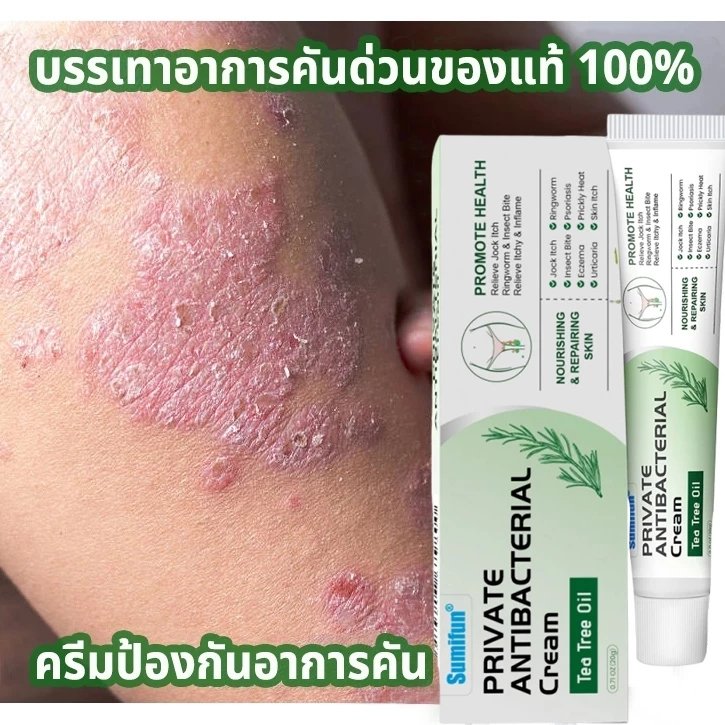 ครีมทาสังคัง สะเก็ดเงินครีม ครีมบำรุงผิว 20g รอยแดง โรคผิวหนัง เกลื้อน กลาก คัน สมุนไพร แก้คันเรื้อรัง คันในร่มผ้า