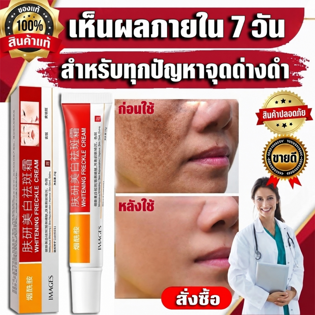 เร็ว ที่มีประสิทธิภาพ ไวท์เทนนิ่งครีมกําจัดกระ/ขอบ เจอรากาต ลบรอยสี ครีมและจุดด่างดํา จุดดํา ลบ酸