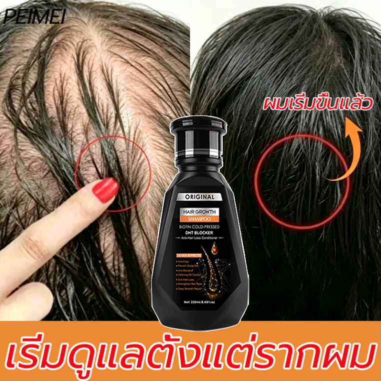 【เร่งกระตุ้นผมเกิดใหม่💫】PEIMEI แชมพูผมร่วง แชมพูขิง ยาสระแก้ร่ว 250ml อ่อนโยน สาระสำคัญของสมุนไพร บำรุงราก ป้องกันหัวล้าน เร่งยาว ซ่อมแซมผมเสีย แชมพูปลูก ยาว สระ หนา ขิงเพียว ดก