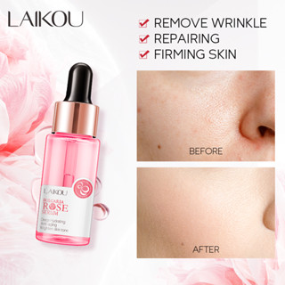 Laikou Bulgaria Rose เซรั่มไวท์เทนนิ่ง กําจัดสิว จุดด่างดํา เอสเซ้นส์ยกกระชับ 17 มล.