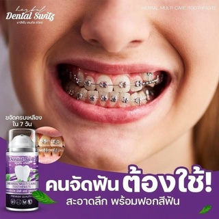 เจลฟอกฟันเองที่บ้านDantalswitz1แถม1