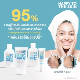 แฮปปี้ทูเดอะสกิน มอยซ์เจอไรเซอร์ลดรอยสิว Happy to The Skin Ever Clear Skin Perfecting Moisturizer
