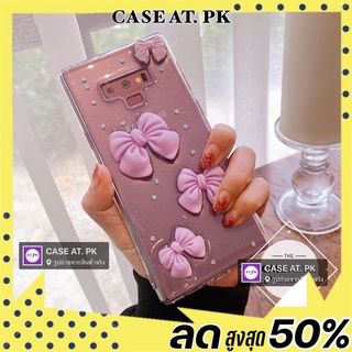 *ร้านไทย*เคสโบว์ case Galaxy samsung s21 ultra Note20 ultra a52 iPhone 12 promax 4โบว์ม่วง น่ารัก