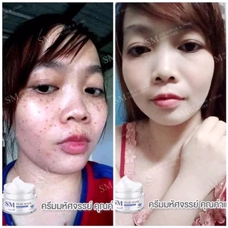 ครีมรกพืชsm ของแท้บริษัท100%[ขายแยก-ยกชุด]10g-15g smskincare