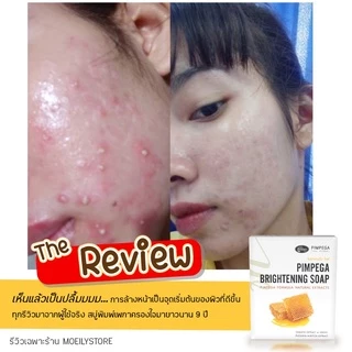 [ส่งไวมาก เปิดขนส่งเอง] สบู่พิมพ์เพกา ลดสิว หน้าสว่างใสอย่างเป็นธรรมชาติ