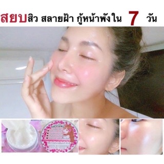 ครีมหน้าวิ้งค์ หน้าฉ่ำวาวใส สิวหาย สลายฝ้า กู้หน้าพังใน7วัน