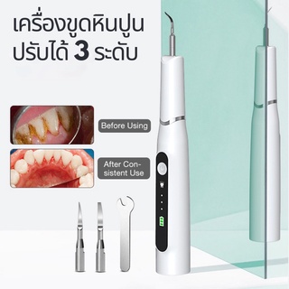 เครื่องขูดหินปูนไฟฟ เครื่องทำความสะอาดฟัน ปรับได้ 3 ระดับ ระบบสั่นอัจฉริยะ 20000ครั้ง alizgirlmart