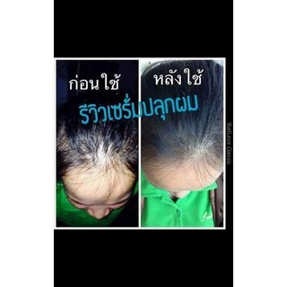❗คุ้ม (แพ็ค2)​ สเปรย์ เร่งผมยาว​ ปลูกผม แก้ผมร่วง แก้ผมบาง ขจัดรังแค บำรุงรากผมใหม่ให้แข็งแรง 120มล.