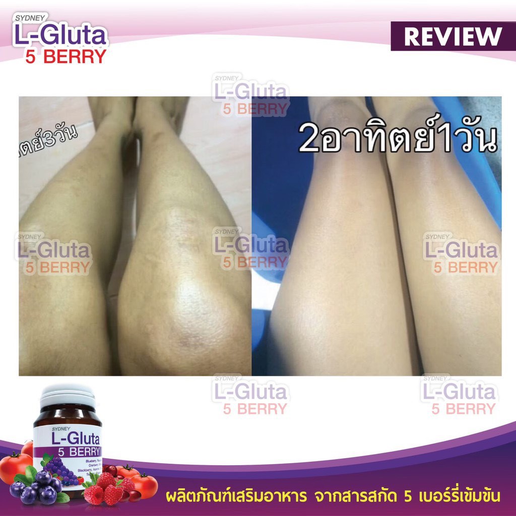 กลูต้า ผิวขาว L-Gluta 5 berry แอล-กลูต้าอาหารเสริม ผิวขาว L Gluta (30 เม็ดx1กระปุก) ราคา ถูกที่สุด ดีลบีเคเค แกลเลอรีภาพที่ 9