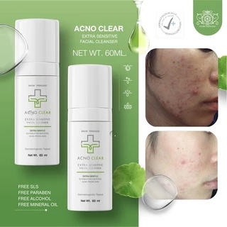 AcnoClear ขนาดใหม่ 60ml🔥🔥 เจลล้างหน้าลดสิว