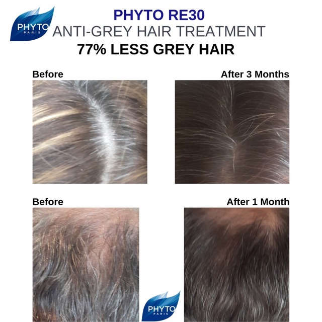 Phyto RE30 เซรั่มแก้ปัญหาผมหงอก ผมขาว (PhytoRe30) - mrseamor - ThaiPick