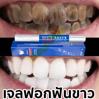 WHITE ฟอกฟันขาว อุปกรณ์ฟอกฟันขาว ฟันดำ คราบชา เจลฟอกฟันขาว  น้ำยาฟอกสีฟัน ยาฟอกฟันขาว เหมาะสำหรับทุกคน